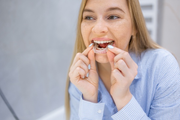 Ways That Clear Aligners Differ From Traditional Aligners